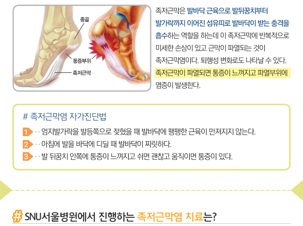 족저근막은 발바닥 근육으로 발뒤꿈치부터 발가락까지 이어진 섬유띠로 발바닥이 받는 충격을 흡수하는 역할을 하는데 이 족저근막에 반복적으로 미세한 손상이 있고 근막이 파열되는 것이 족저근막염이다. 퇴행성 변화로도 나타날 수 있다. 족저근막이 파열되면 통증이 느껴지고 파열부위에 염증이 발생한다./
			# 족저근막염 자가진단법 : 1.엄지발가락을 발등쪽으로 젖혔을 때 발바닥에 팽팽한 근육이 만져지지 않는다., 2.아침에 발을 바닥에 디딜 때 발바닥이 찌릿하다., 3.발 뒤꿈치 안쪽에 통증이 느껴지고 쉬면 괜찮고 움직이면 통증이 있다./
			Q.SNU서울병원에서 진행하는 족저근막염 치료는?