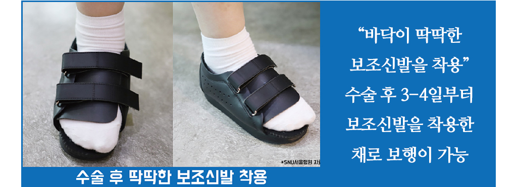 “바닥이 딱딱한 보조신발을 착용” 수술 후 3-4일부터 보조신발을 착용한 채로 보행이 가능
