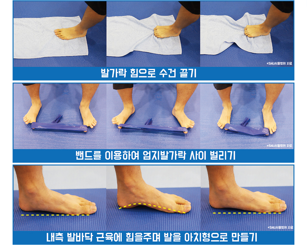 발가락 힘으로 수건 끌기, 밴드를 이용하여 엄지발가락 사이 벌리기, 내측 발바닥 근육에 힘을 주며 발을 아치형으로 만들기