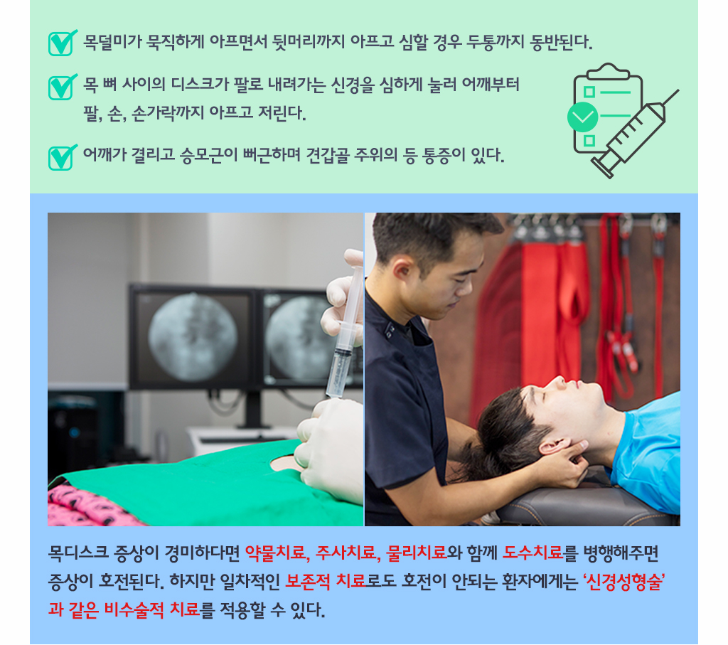 
			목덜미가 묵직하게 아프면서 뒷머리까지 아프고 심할 경우 두통까지 동반된다.
			목 뼈 사이의 디스크가 팔로 내려가는 신경을 심하게 눌러 어깨부터 팔, 손, 손가락까지 아프고 저린다. 
			어깨가 결리고 승모근이 뻐근하며 견갑골 주위의 등 통증이 있다.
			목디스크 증상이 경미하다면 약물치료, 주사치료, 물리치료와 함께 도수치료를 병행해주면 증상이 호전된다. 하지만 일차적인 보존적 치료로도 호전이 안되는 환자에게는 ‘신경성형술’ 과 같은 비수술적 치료를 적용할 수 있다.