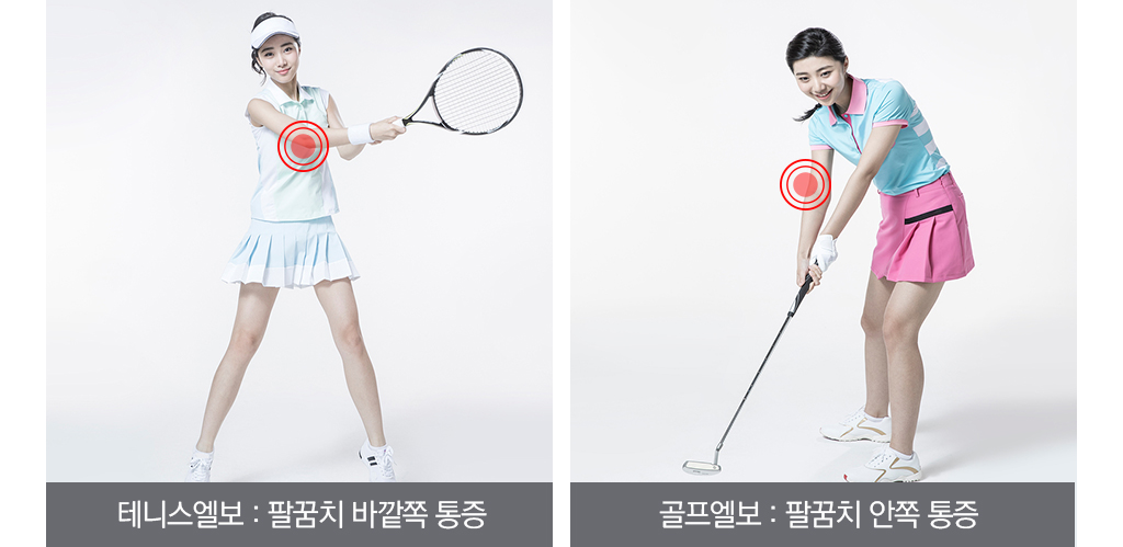 테니스엘보 : 팔꿈치 바깥쪽 통증 / 골프엘보 : 팔꿈치 안쪽 통증