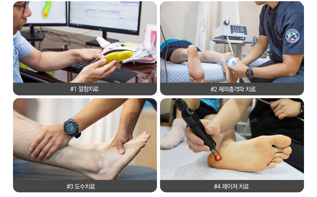 #1깔창치료, #2체외충격파 치료, #3도수치료, #4레이저 치료
