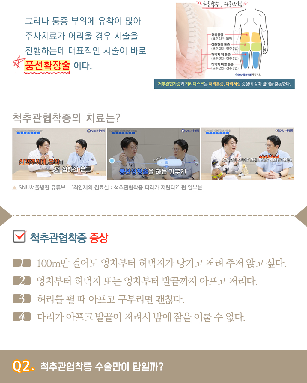 그러나 통증 부위에 유착이 많아 주사치료가 어려울 경우 시술을 진행하는데 대표적인 시술이 바로 풍선확장술 이다.
			척추관협착증의 치료는?
			SNU서울병원 유튜브 – ‘최인재의 진료실 : 척추관협착증 다리가 저린다?’ 편 일부분
			척추관협착증 증상
			1. 100m만 걸어도 엉치부터 허벅지가 당기고 저려 주저 앉고 싶다.
			2. 엉치부터 허벅지 또는 엉치부터 발끝까지 아프고 저리다.
			3. 허리를 펼 때 아프고 구부리면 괜찮다.
			4. 다리가 아프고 발끝이 저려서 밤에 잠을 이룰 수 없다.
			Q2. 척추관협착증 수술만이 답일까?
