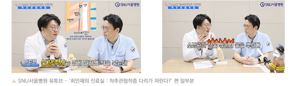 SNU서울병원 유튜브 – ‘최인재의 진료실 : 척추관협착증 다리가 저린다?’ 편 일부분