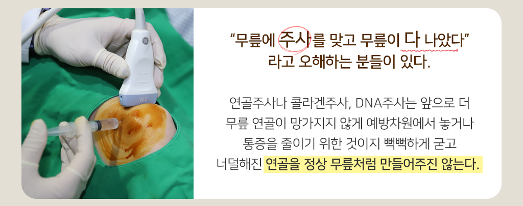 “무릎에 주사를 맞고 무릎이 다 나았다” 라고 오해하는 분들이 있다.
			연골주사나 콜라겐주사, DNA주사는 앞으로 더 무릎 연골이 망가지지 않게 예방차원에서 놓거나 통증을 줄이기 위한 것이지 뻑뻑하게 굳고 너덜해진 연골을 정상 무릎처럼 만들어주진 않는다. 