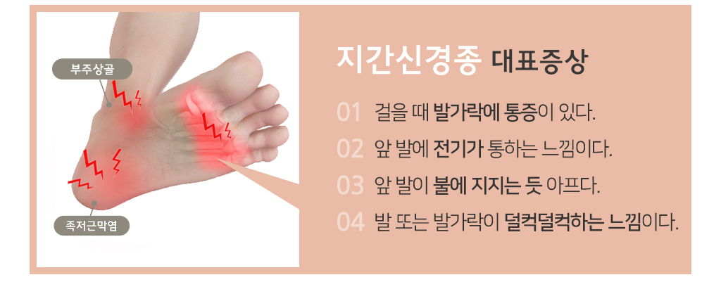 지간신경종 대표증상1.걸을 때 발가락에 통증이 있다.2.앞 발에 전기가 통하는 듯한 느낌이다.3.앞 발이 불에 지지는 듯 아프다4.발 또는 발가락이 덜컥덜컥하는 느낌이다.