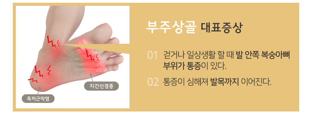 부주상골 대표증상 1.걷거나 일상생활 할 때 발 안쪽 복숭아뼈 부위가 통증이 있다. 2.통증이 심해져 발목까지 이어졌다.