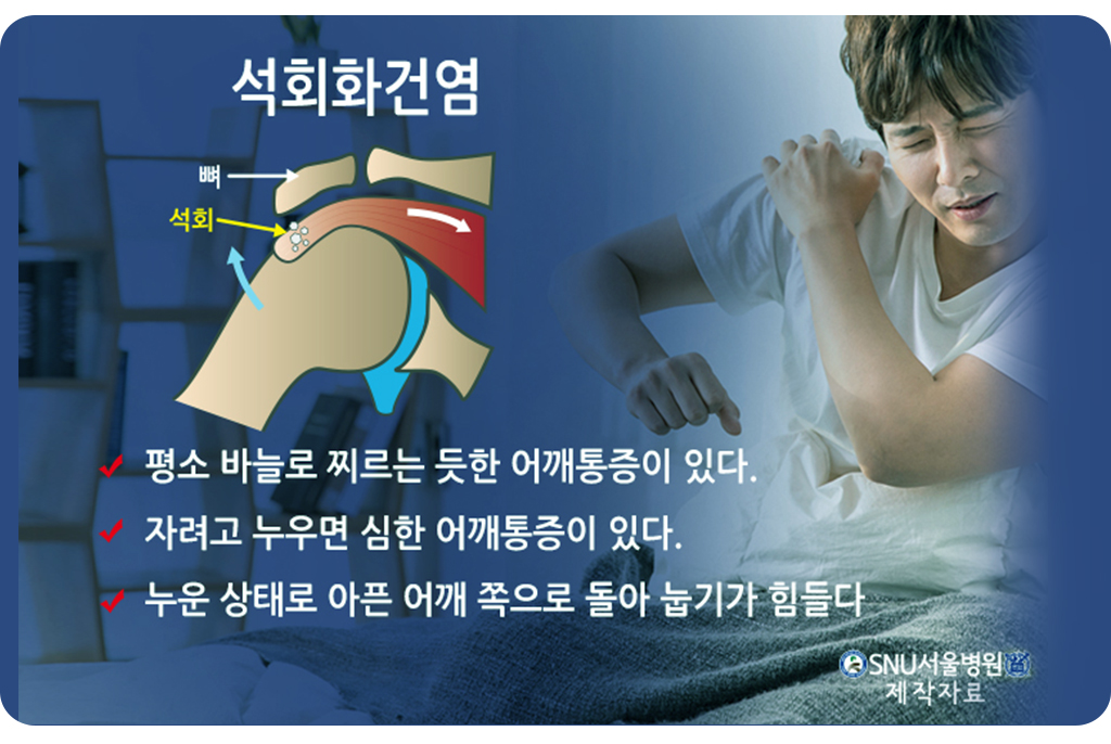 석회화건염 증상들