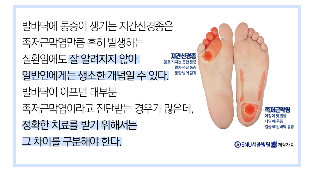  발바닥에 통증이 생기는 지간신경종은 족저근막염만큼 흔히 발생하는 질환임에도 잘 알려지지 않아 일반인에게는 생소한 개념일 수 있다. 발바닥이 아프면 대부부 ㄴ족저근막염이라고 진단받는 경우가 많은데, 정확한 치료를 받기 위해서는 그 차이를 구분해야 한다. 