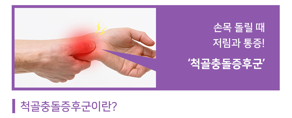 손목 돌릴 때 저림과 통증  척골충돌증후군  척골충돌증후군이란?