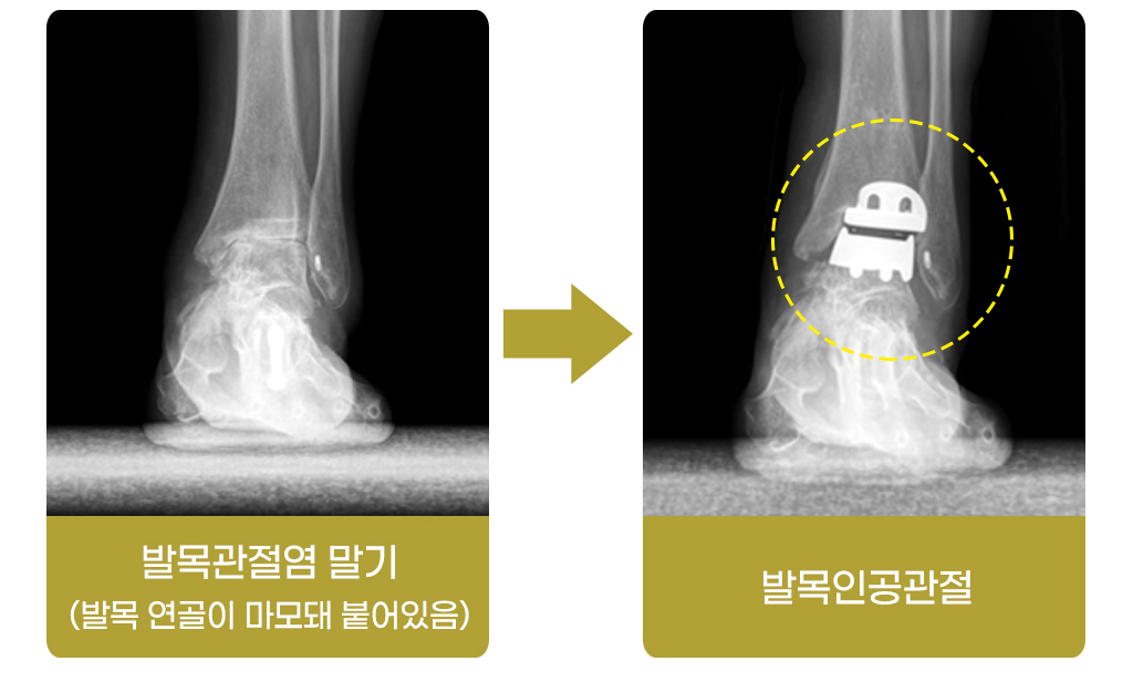 단 나누기