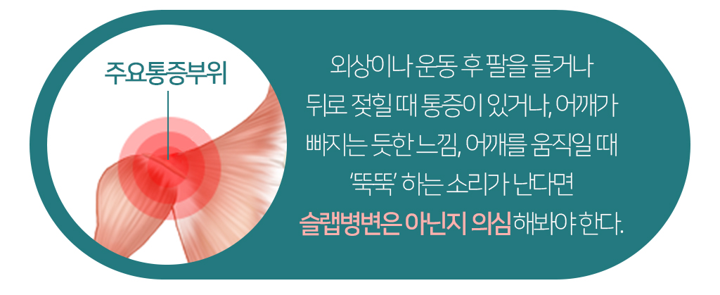 주요통증부위사진, 외상이나 운동 후 팔을 들거나 뒤로 젖힐 때 통증이 있거나, 어깨가 빠지는 듯한 느낌, 어깨를 움직일 때 ‘뚝뚝’ 하는 소리가 난다면 슬랩병변은 아닌지 의심해봐야 한다.