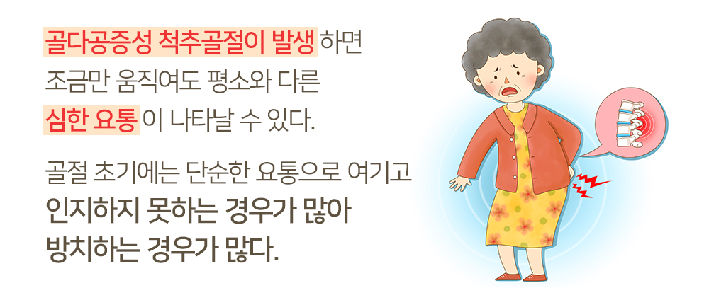 골다공증성 척추골절이 발생 하면 조금만 움직여도 평소와 다른 심한 요통 이 나타날 수 있다. 골절 초기에는 단순한 요통으로 여기고 인지하지 못하는 경우가 많아 방치하는 경우가 많다.