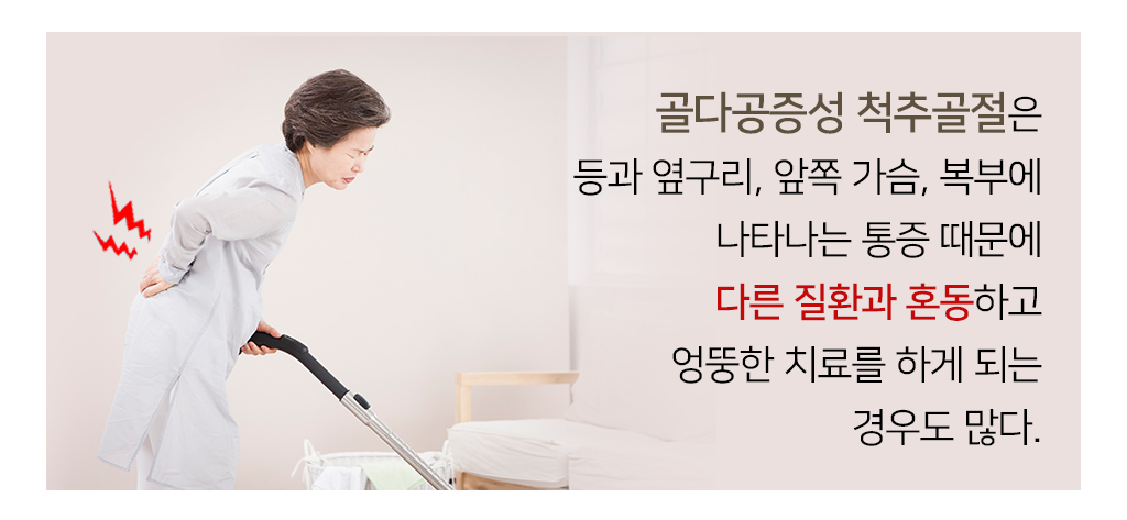 골다공증성 척추골절은 등과 옆구리, 앞쪽 가슴, 복부에 나타나는 통증 때문에 다른 질환과 혼동하고 엉뚱한 치료를 하게 되는 경우도 많다.